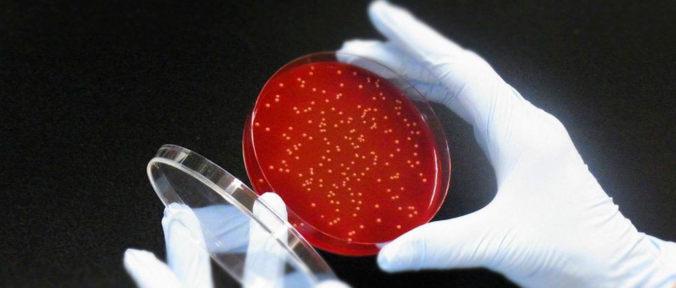 Japan’s Anaeropharma Science gets $13.1m led by European VC Seventure Partners