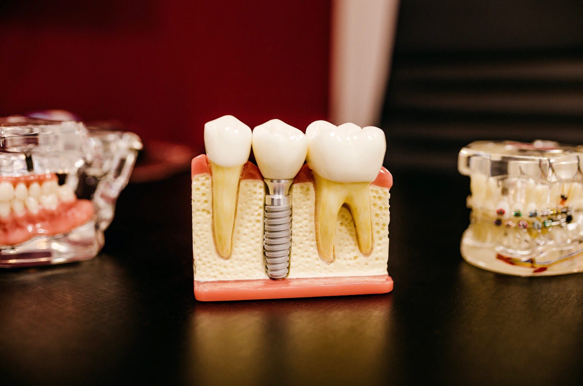 SoftBank Vision Fund 2 leads over $100m round in China's dental 3D-printing firm SprintRay