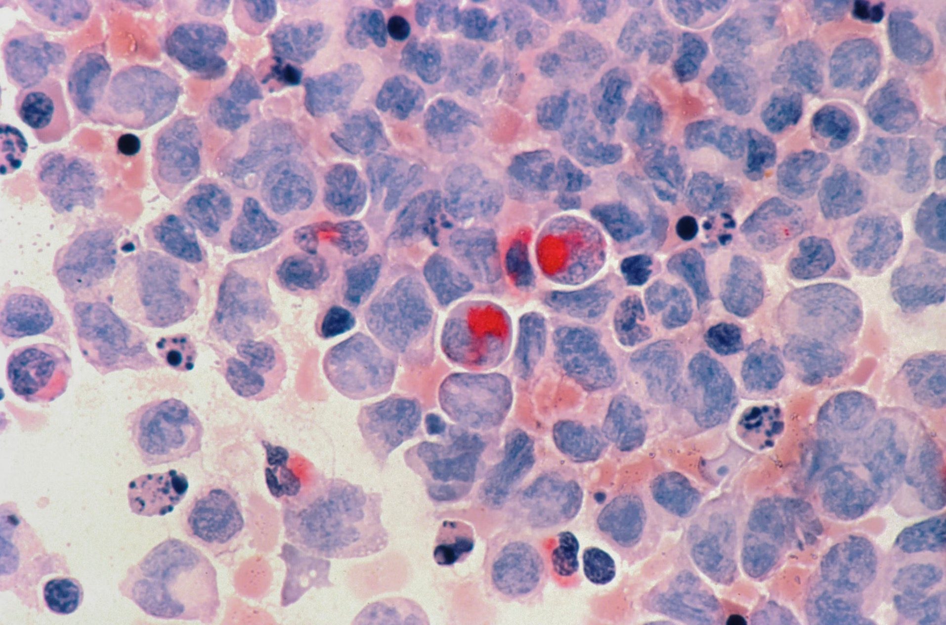 Qiming-backed drugmaker Oricell raises $45m to advance pipeline in US